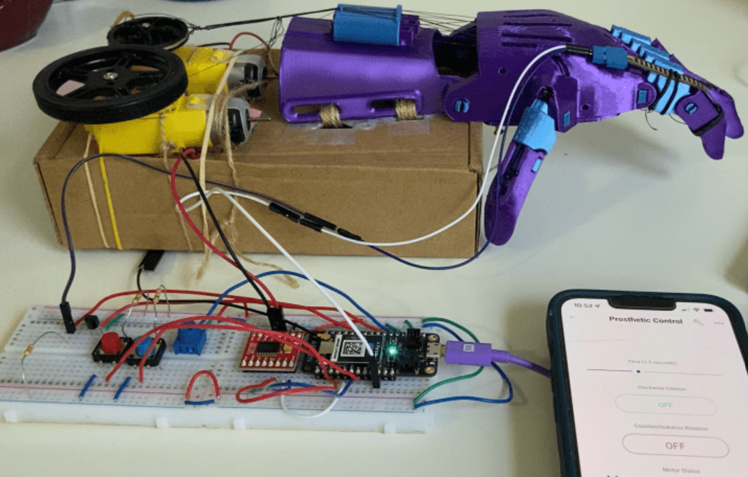 Molly's purple motorized prosthetic hand with its control electronics and phone interface